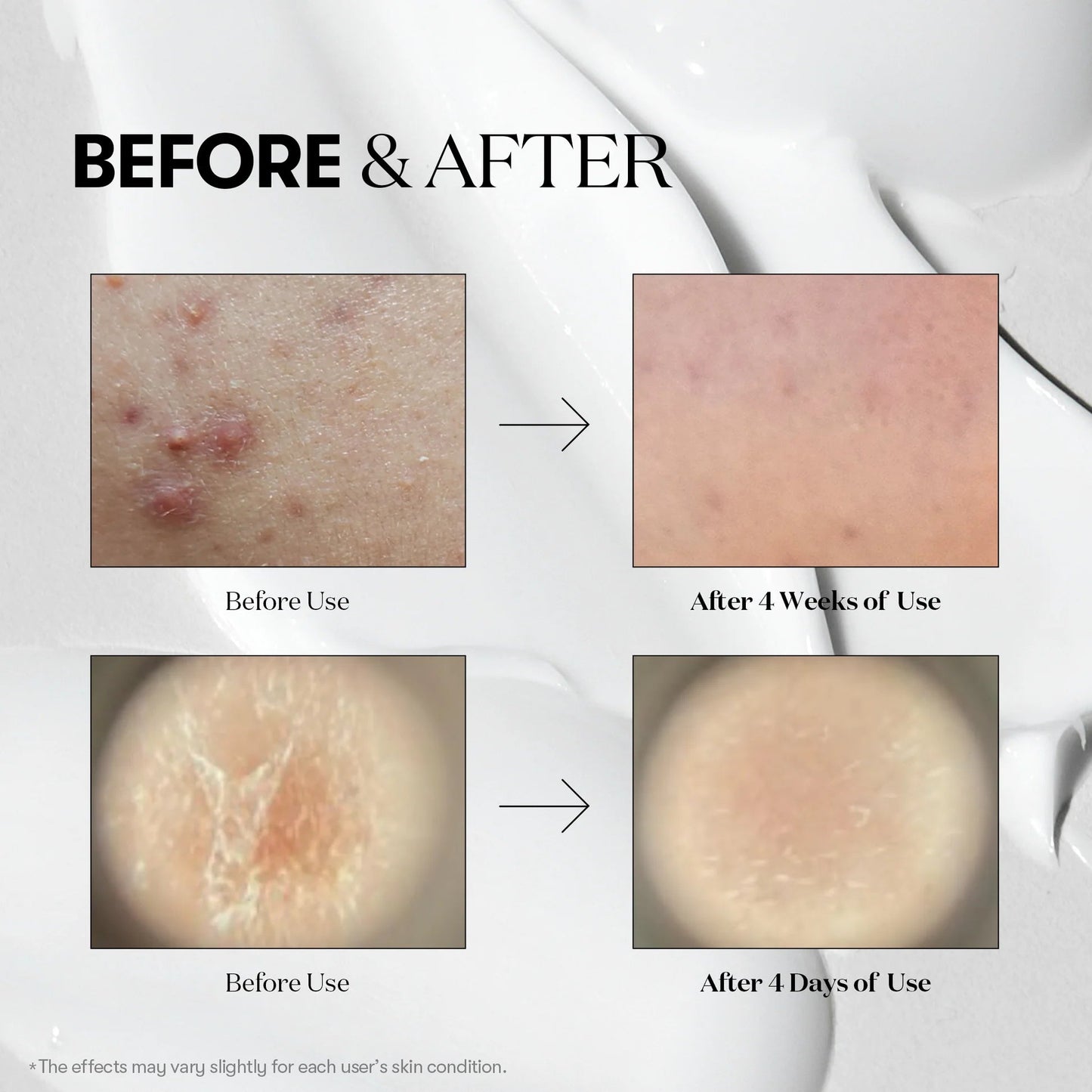 Reedle Shot 300 Booster for Skin Improvement 50ml