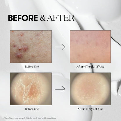 Reedle Shot 300 Booster for Skin Improvement 50ml